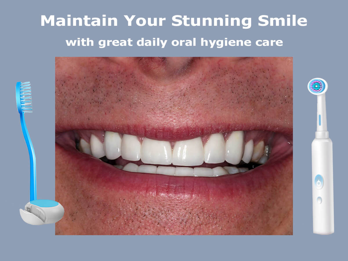 Adult Daily Oral Hygiene Care – Montgomery Dental Care