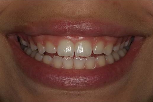 Periodontal Cosmetic Procedures at Montgomery Dental Clinic - Copy