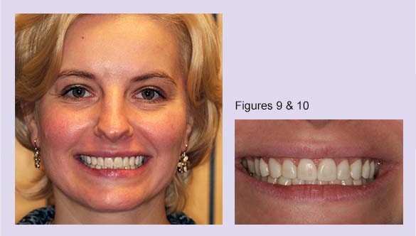 esthetic-dentistry-appointment-woodbury-minnesota-c